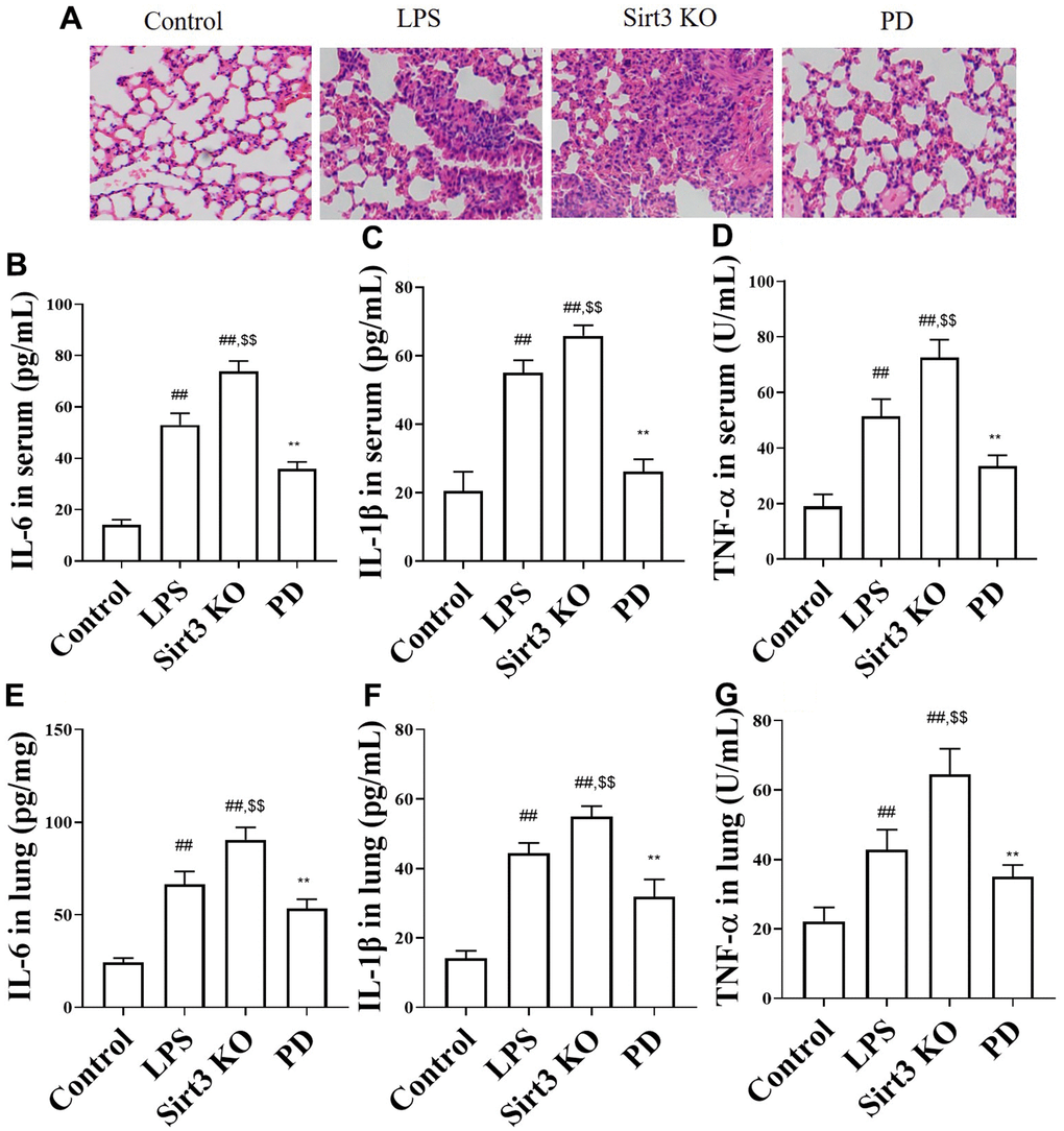 The effects of PD on lung histopathology and cytokine in sepsis mice. (A) Representative heart tissue sections photomicrographs for hematoxylin-eosin (HE) staining. Original magnification: 200, scale bar: 50 μm. (B–D) The levels of TNF-α, IL-1β, IL-6 in serum. (E–G) The levels of IL-6, TNF-a and IL-1β. All the data was presented as mean ± SD. Compared with control group: #P##P*P**P