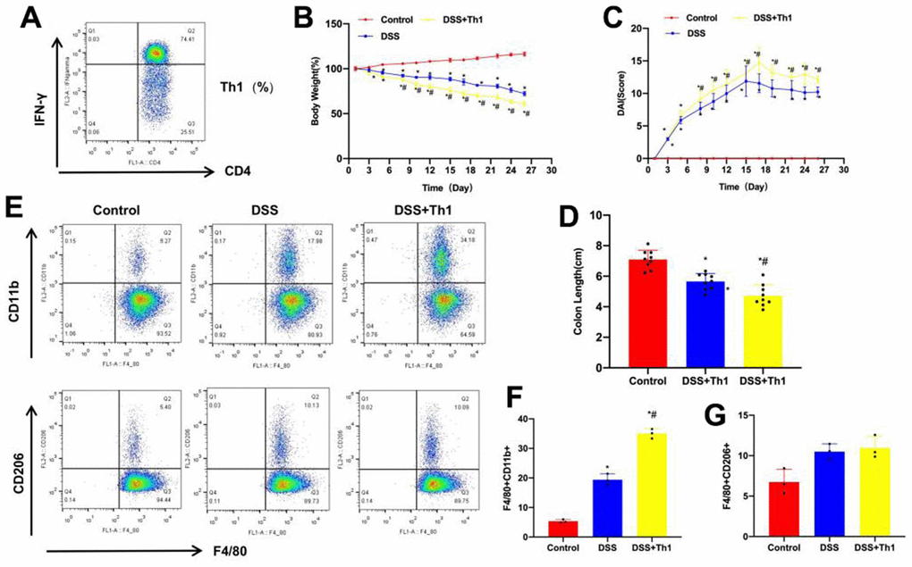 Transcription factor KLF4 regulated STAT1 to promote M1 polarization of  macrophages in rheumatoid arthritis