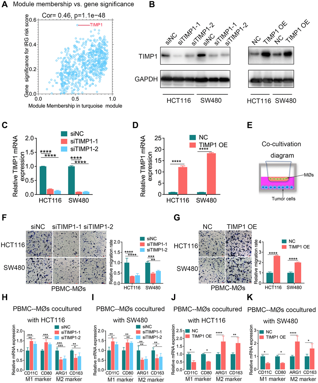 TIMP1 was the hub gene of the inflammatory response and promoted macrophage infiltration and M2-like polarization in CRC. (A) Scatterplot of gene significance for the IRG risk score and module membership in the turquoise module. (B–D) The knockdown and overexpression of TIMP1 were confirmed with Western blotting (B) and qPCR (C and D). (E) Diagram of colorectal cancer cells cocultured with macrophages. (F, G) The migration ability of macrophages was confirmed with Transwell assays in the TIMP1 knockdown group (F) and TIMP1 overexpression group (G). (H–K) PCR results of detecting the polarization of macrophages under different cocultures with CRC cells (Student’s t test or one-way ANOVA, n = 3). (Data are presented as the means ± standard deviations; *indicates P **indicates P ***indicates P ****indicates P 