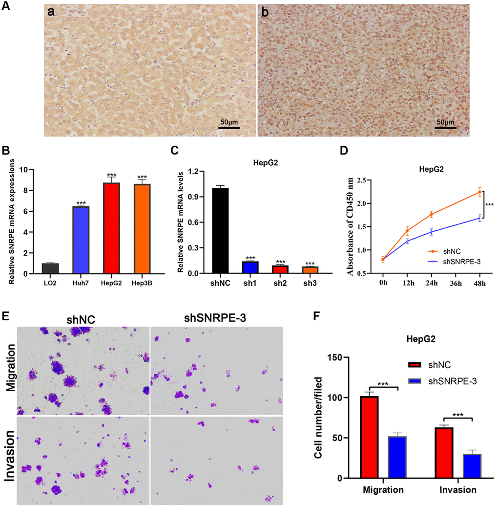 Immunohistochemistry and cell experiments of gene SNRPE to validate our results. (A) Compared with adjacent normal liver tissues (a), SNRPE protein expression was significantly overexpressed in HCC tissues (b) (×200 magnification). (B) SNRPE mRNA expression was greater in HCC cells than in the normal liver cells. (C) The shSNRPE with lentiviral transfection was transfected into HepG2 cells. (D) CCK8 assay. After SNRPE knockdown, the HepG2 cells exhibited a significant inhibition in viability. (E, F) Transwell assay. After SNRPE knockdown, the HepG2 cells exhibited a significant inhibition in migration and invasion.