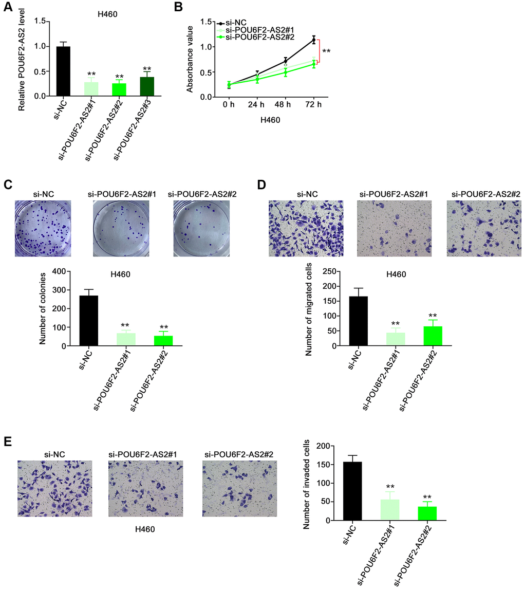 Disturbing POU6F2-AS2 expression hampers the malignant phenotype of NSCLC cells. (A) The knockdown efficiency of si-POU6F2-AS2 in H460 cells was uncovered by qRT-PCR. ***P B and C) The proliferation and colony-forming of POU6F2-AS2-silenced H460 cells. **P D and E) The motility of H460 cells after POU6F2-AS2 downregulation. **P 