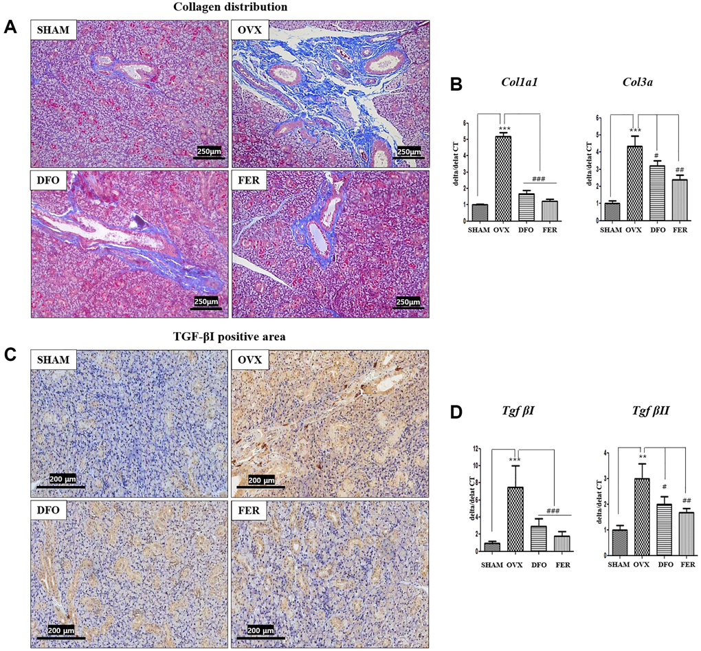 Fibrosis in the submandibular gland. (A) Collagen distribution in the salivary gland tissue. The fibrotic area was significantly larger in the OVX group than in the SHAM group, while in both the DFO and the FER group it was smaller than in the OVX group. (B) Expression of Col1a1 and Col3a mRNAs. The expression of collagen type I alpha 1 chain (Col1a1) and collagen type III alpha chain (Col3a) mRNAs also increased in the OVX group (p Col1a1; p Col3a; p Col1a1; p Col3a; p C) Immunohistochemical assessment of TGF-βI levels. The brown staining reflects TGF-βI expression. The TGF-βI staining was higher in the OVX group than in the SHAM group and decreased in both the DFO and the FER group compared with that in the OVX group. (D) Expression of Tgf-βI and Tgf-βII mRNAs. The expression of Tgf-βI and Tgf-βII mRNAs increased in the OVX group (Tgf-βI; p Tgf-βII; p Tgf-βI; p Tgf-βII; p Tgf-βI; p Tgf-βII; p **p ***p #p ##p ###p 