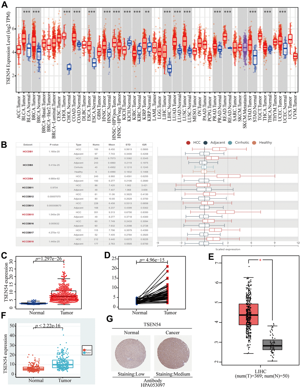 The expression analysis of TSEN54 in HCC. (A) Differential expression of TSEN54 in pan-carcinoma and corresponding normal tissues in TIMER. (B) Charts and graphs present the TSEN54 expression in HCC and normal tissues downloaded from the HCCDB database. (C) Plots describe the mRNA expression level of TSEN54 in normal and HCC samples. (D) Paired differential expression of TSEN54 in normal and HCC tissues. The difference representation of TSEN54 in HCC and normal samples was plotted using the (E) GEPIA website and the (F) ICGC database. (G) IHC staining results show the protein expression level of TSEN54 in liver normal tissues and tumor tissues.