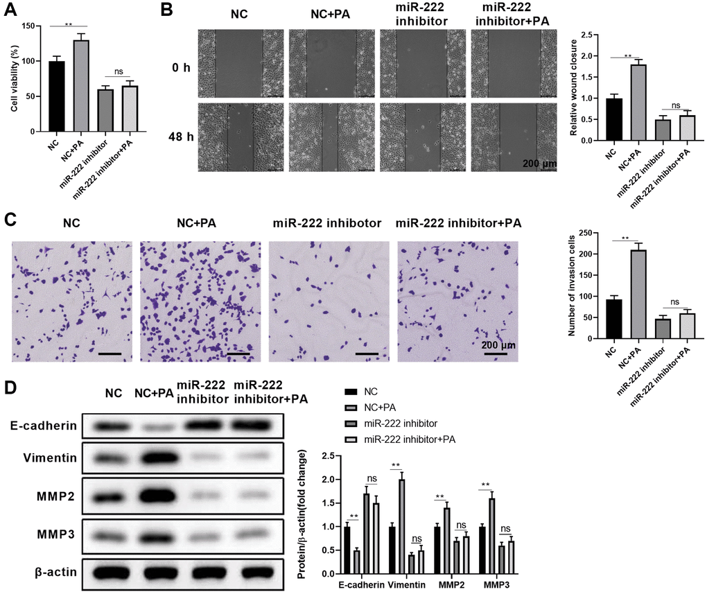Functional miR-222 blockade reversed the palmitic acid promoting effects on RPEC migration. (A–D) ARPE-19 cells were transfected with control (NC) or miR-122-specific inhibitors. After 48 h, cells were left untreated, or further treated with 200 μM PA for another 48 h during the indicated assays: (A) Cell viability, (B) wound healing ability, and (C) migration of the indicated ARPE-19 cells. Representative images are shown on left, and the relative wound closure (B) and numbers of invaded cells (C) were summarized. Scale bar, 200 μm. (D) The protein levels of E-cadherin, vimentin, MMP2, and MMP3 in the indicated ARPE-19 cells. Representative bands images are shown, and the relative protein levels were quantitated. n = 3 for each group; *P **P 