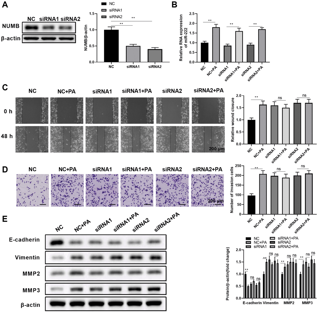 NUMB knockdown abolished the palmitic acid promoting effect in RPEC migration. (A) NUMB protein levels in ARPE-19 cells at 48 hours after transfection of negative control (NC) or NUMB-specific siRNA (siRNA1 and siRNA2) oligos. (B–E) ARPE-19 cells were separately transfected with NC, siRNA1, and siRNA2. After 48 h, cells were left untreated or treated with 200 μM palmitic acid for another 48 h in the subsequent assays. (B) miR-222 levels in the indicated cells after palmitic acid administration for 48 h. (C) Wound healing ability and (D) migration ability of the indicated ARPE-19 cells. (E) E-cadherin, vimentin, MMP2, and MMP3 protein levels in the indicated ARPE-19 cells. Representative images are shown, and the summarized data were from three independent results. n = 3 for each group; *P **P 