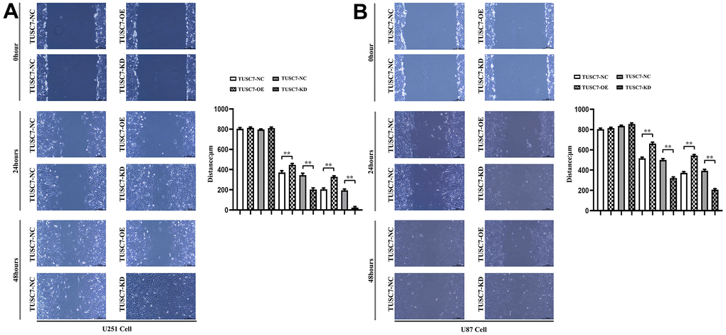 Overexpression of TUSC7 suppressed migration of glioma cells. (A) Wound healing assay results of U251 cells. (B) Wound healing assay results of U87 cells. The results of wound healing assay displayed that overexpression of TUSC7 dramatically suppressed the wound healing rate of U251 and U87 cells, whereas it was obviously improved after silencing TUSC7. **p