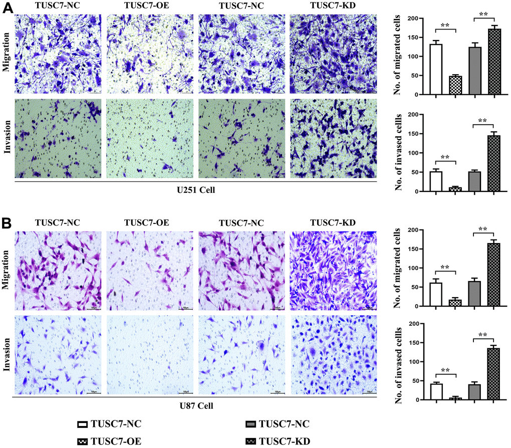 Overexpression of TUSC7 suppressed migration and invasion of glioma cells. (A) Transwell assay results of U251 cells. (B) Transwell assay results of U87 cells. The results of Transwell assay denoted that overexpression of TUSC7 distinctly inhibited the migration and invasion abilities of U251 and U87 cells compared with NC group, while they were evidently enhanced after silencing TUSC7. **p