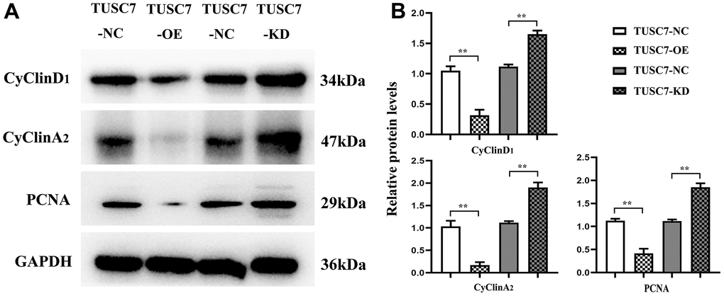 Overexpression of TUSC7 suppressed expressions of cyclin in glioma cells. (A) Protein bands of cyclin. (B) Relative protein expressions of cyclin. The results of Western blotting revealed that after overexpression of TUSC7, the expressions of cyclinD1, cyclinA and PCNA apparently declined compared with those in NC group, whereas they were overtly increased after silencing TUSC7. **p