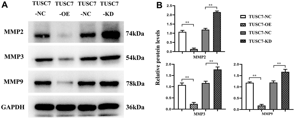 Overexpression of TUSC7 suppressed expressions of MMPs in glioma cells. (A) Protein bands of MMPs. (B) Relative protein expressions of MMPs. Western blotting results showed that TUSC7 overexpression group had significantly lower expressions of MMP2, MMP3 and MMP9 than NC group, whereas they were obviously elevated after silencing TUSC7. **p