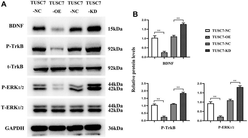 Overexpression of TUSC7 could inhibit the expressions of BDNF/TrkB/ERK pathway-related proteins. (A) BDNF/TrkB/ERK pathway-related protein bands. (B) Relative expressions of BDNF/TrkB/ERK pathway-related proteins. Western blotting revealed that TUSC7 overexpression group displayed remarkably lower expression levels of BDNF, p-TrkB and ERK1/2 than NC group, whereas they were transparently raised after silencing TUSC7. **p
