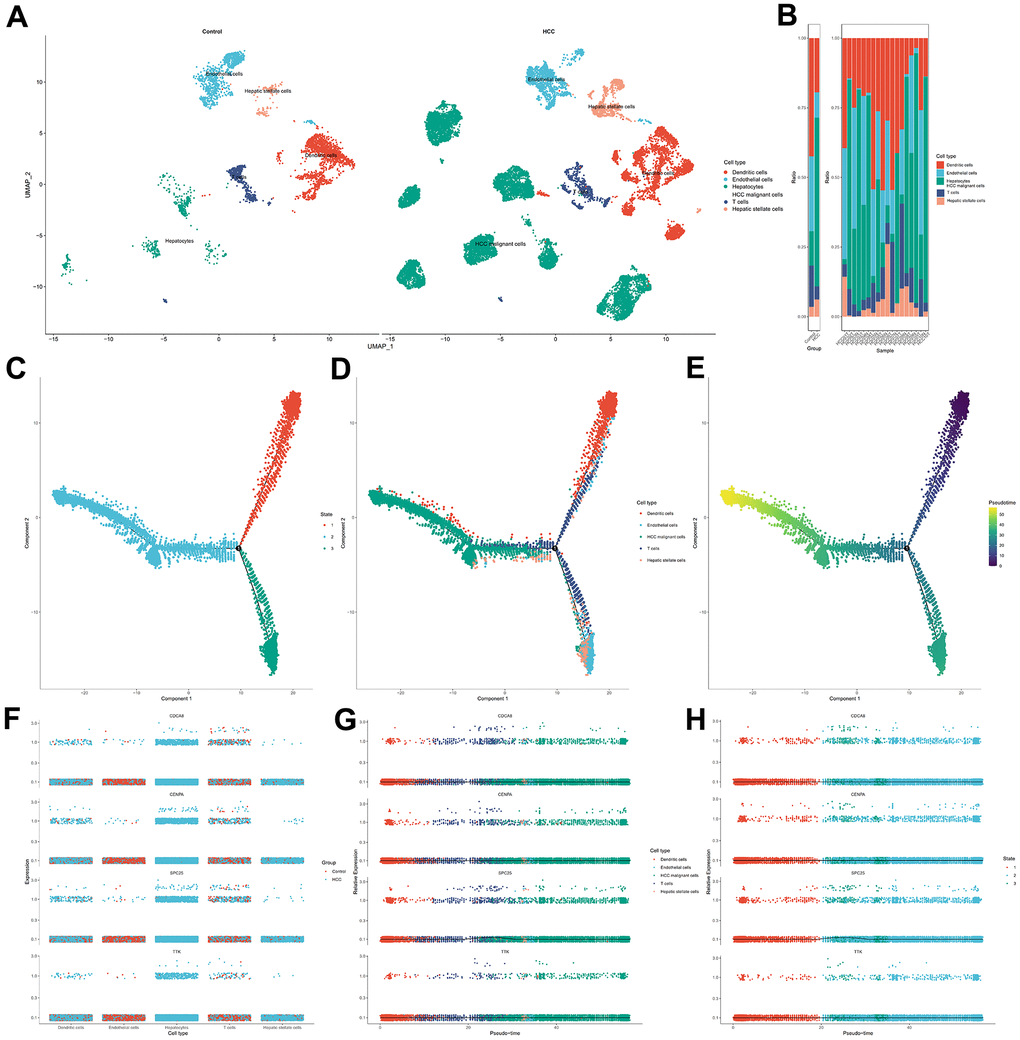 Single cell analysis for the four hub genes in cellular senescence-related prognostic signature. (A) Visualization of cell types in non-tumor liver specimens and HCC specimens. (B) The frequency of cells in two groups. (C) Cells in HCC were colored based on state. (D) Distribution of cells in HCC in pseudo-time trajectory. (E) Cells were colored on the basis of pseudo-time. (F) The dithering plot shows the expressions of the four hub genes in five cell types between control and HCC samples. (G) Pseudo-time analysis for expression kinetics of four hub genes in cell types trajectory. (H) Pseudo-time analysis for expression kinetics of four hub genes in different states trajectory of cells.