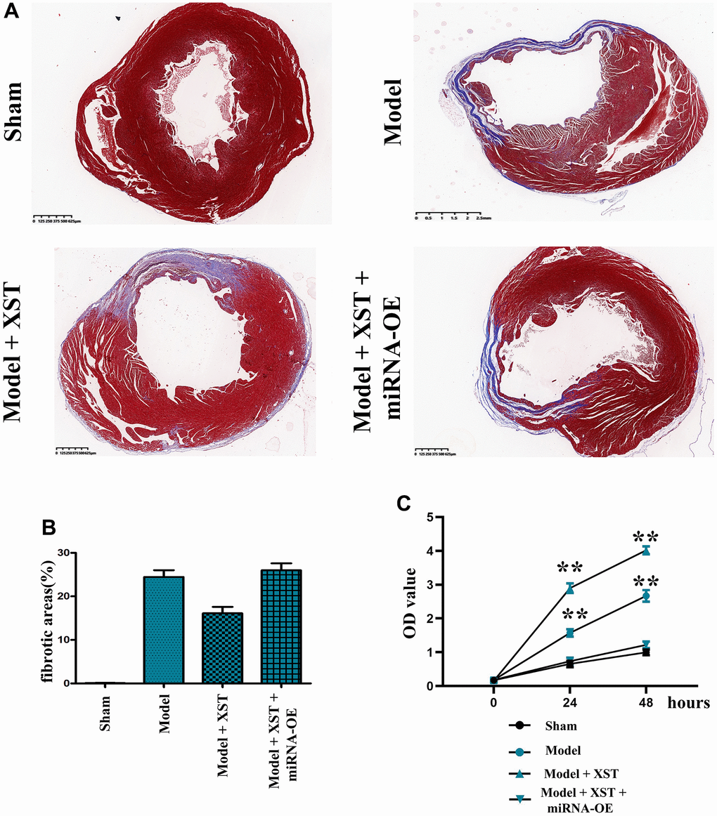 Changes of cardiac fibrosis in mice and cell proliferation capacity detected via MTT assay. (A) Masson staining of the mouse heart. (B) Statistical results of the proportion of cardiac fibrosis areas in mice. (C) The OD value detected by MTT.