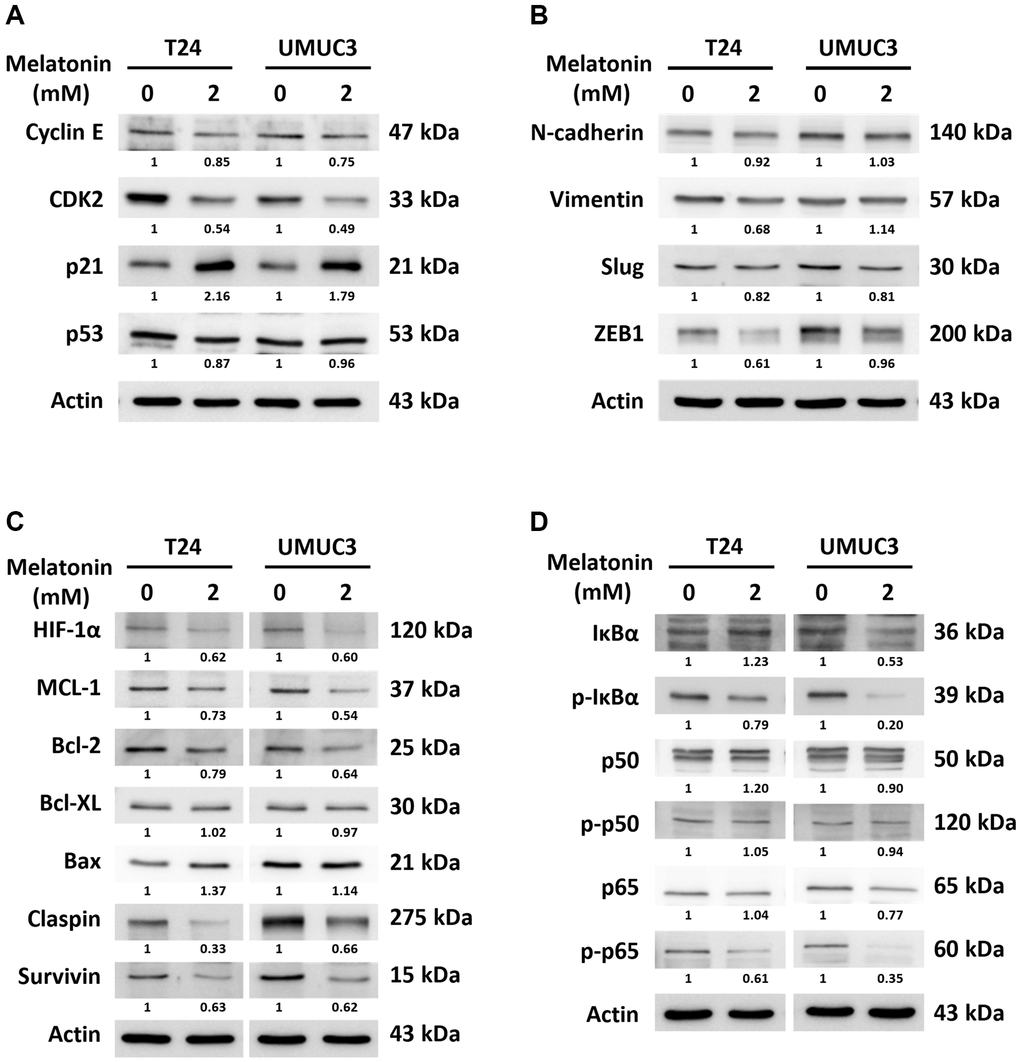 Validation of cell cycle, apoptosis, and metastasis-related protein expressions via western blotting. The protein expressions changed by a 24- or 48-hour melatonin treatment on UBUC cells were measured via western blotting, including of (A) cell cycle arrest-related proteins, (B) metastasis-related proteins, and (C, D) apoptosis-related proteins.