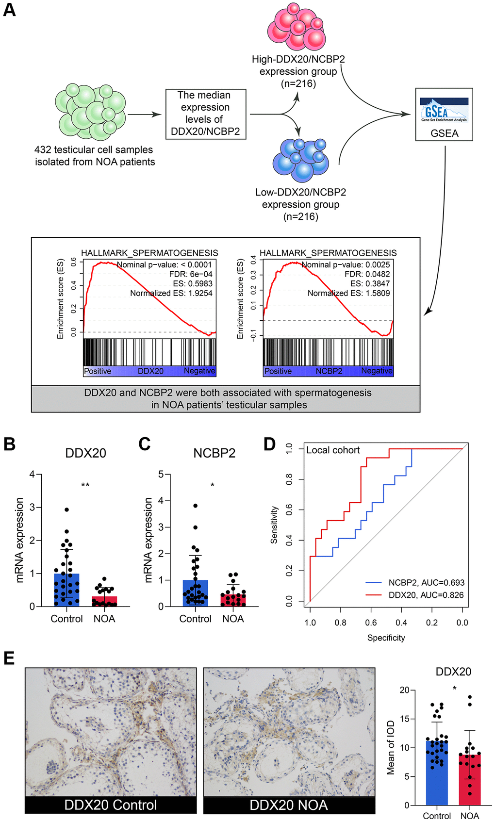 The external validation of DDX20 and NCBP2. (A) The single-cell RNA-sequencing analysis of 432 testicular cell samples isolated from NOA patients displayed that DDX20 and NCBP2 were both positively associated with spermatogenesis. (B, C) DDX20 (B) and NCBP2 (C) were down-regulated in the seminal plasma samples of NOA patients from the local hospital. (D) The ROC curve exhibited the diagnosis ability of seminal plasma DDX20 and NCBP2 to NOA in the local cohort. (E) The protein expression levels of DDX20 were obviously down-regulated in the testicular samples from NOA patients in the local cohort, which were detected by the immunohistochemical staining. Abbreviation: ROC: receiver operating characteristic.