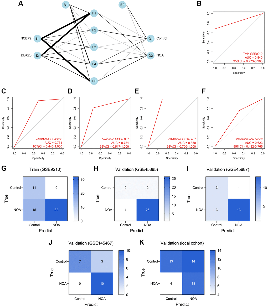 Establishment and validation of an ANN diagnosis model. (A) An ANN model containing one input layer, one hidden layer, and one output layer was constructed to diagnose NOA. (B–F) The ROC analyses of the ANN model in the training cohort (B), GSE45885 cohort (C), GSE45887 cohort (D), GSE145467 cohort (E), and the local cohort (F). (G–K) The confusion matrices of the RF model in the training cohort (G), GSE45885 cohort (H), GSE45887 cohort (I), GSE145467 cohort (J), and the local cohort (K). Abbreviation: ANN: artificial neural network.