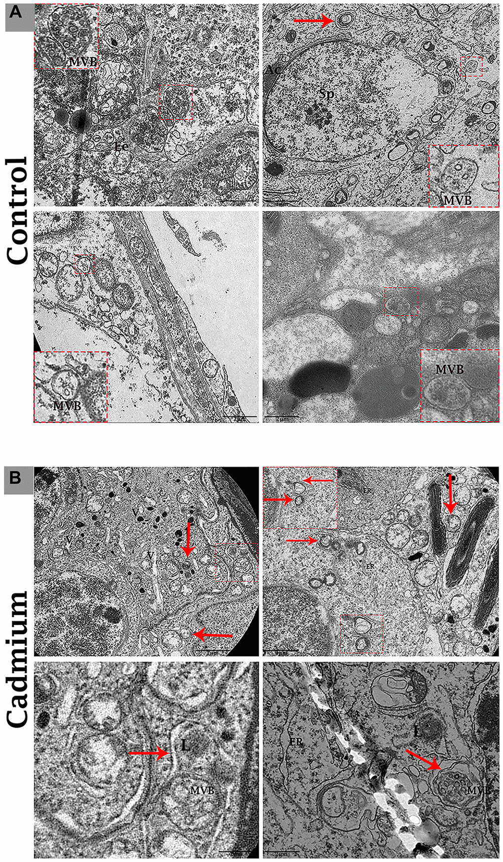 Electron micrograph of MVBs in the seminiferous tubules of control (A) and cadmium (B) treated group. (A) Seminiferous tubules containing several MVBs and limited formation of autophagosome. (B) Seminiferous tubules containing numerous formations of autophagosome and limited MVBs. Ee: early endosome; MVBs: multivesicular bodies; Ac: acromion process; Sp: spermatozoa; ER: endoplasmic reticulum; L: lysosome; (arrow) autophagosome. Scale bars 2 μm.