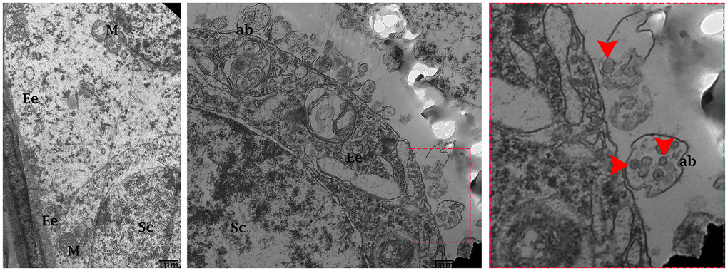Electron micrograph of exosomes in the seminiferous tubules of control group. Seminiferous tubules containing formation of early endosomes and MVBs within the cytoplasmic of Sertoli cells. Apical blebs formation connected with plasma membrane of Sertoli cell. Sc: Sertoli cell; Ee: early endosome; MVBs: multivesicular bodies; M: mitochondria; ab: apical blebs; (arrow head) exosome. Scale bars 1 μm.