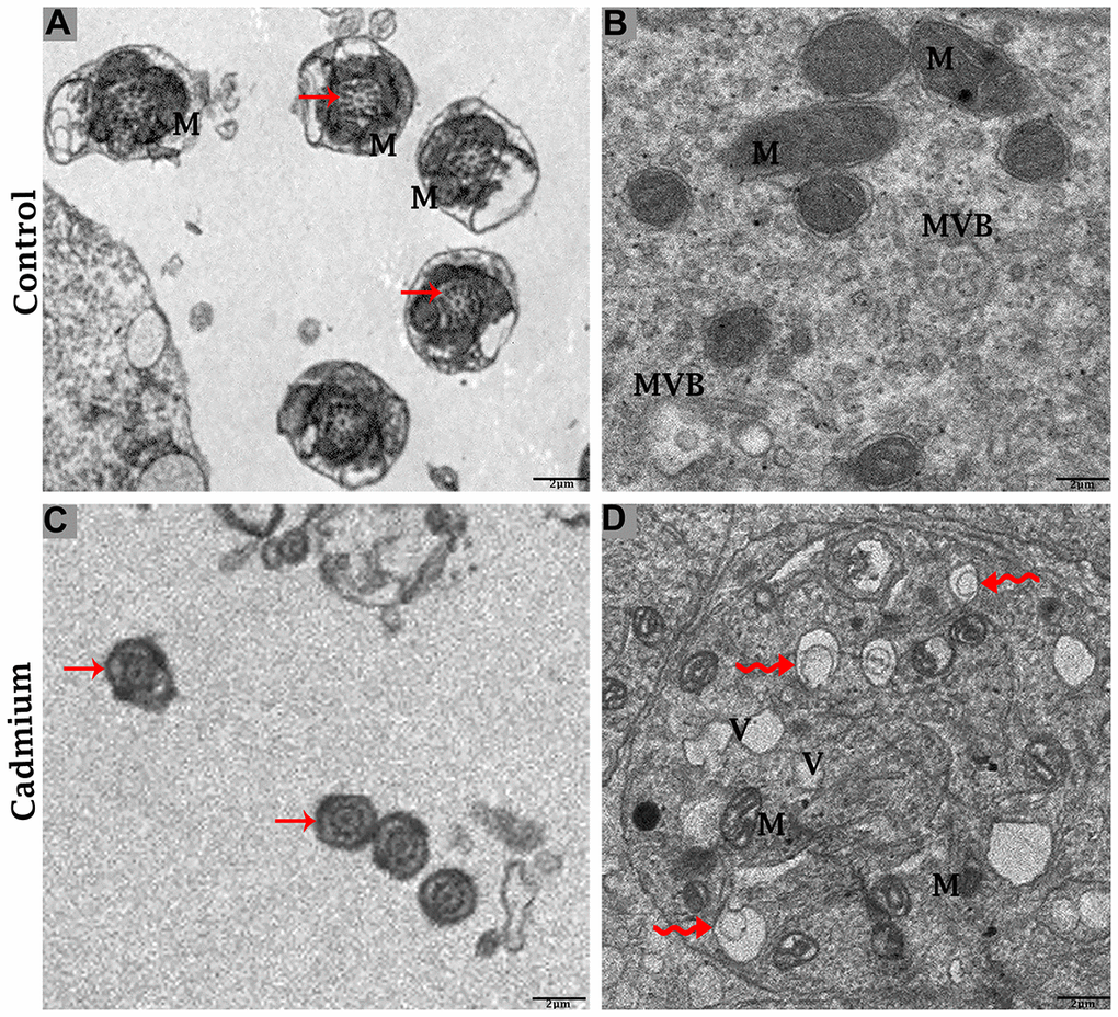 Electron micrograph of ultrastructures of mid-peace of spermatozoa and Sertoli cells of control (A, B) and cadmium treated (C, D) group. M: mitochondria; MVBs: multivesicular bodies; V: vacuole; (curved arrow) autophagosome; (arrow) axoneme. Scale bars 2 μm.