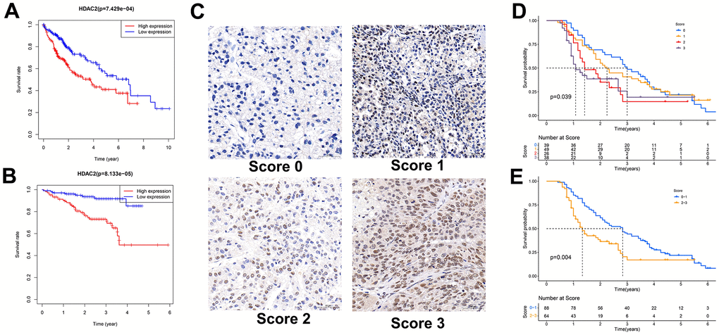 Relationship between HDAC2 expression and patient survival. (A) Kaplan-Meier survival analysis of patients with different HDAC2 expressions in TCGA-LIHC cohort. (B) Kaplan-Meier survival analysis of patients with different HDAC2 expressions in ICGC-JP cohort. (C) Scored for each sample of the tissue microarray. (D, E) Kaplan-Meier survival analysis of patients with different tissue scores in the tissue microarrays.