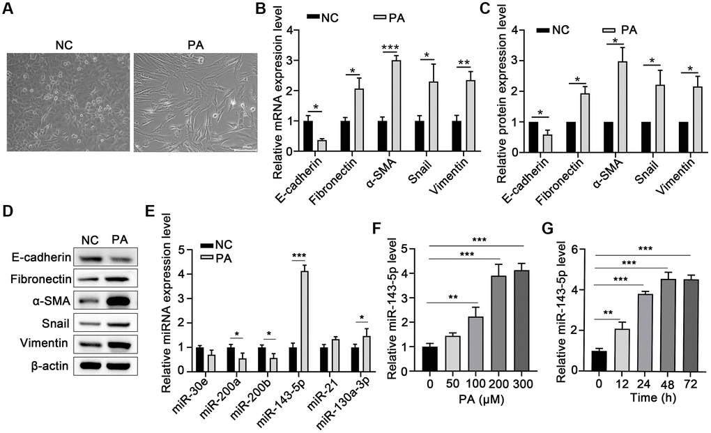 PA induced EMT and increased miR-143-5p expression in ARPE-19 cells. (A) Morphological alteration of ARPE-19 cells after treating with PA. Scale bar, 200 μm. (B) mRNA expression of E-cadherin, Fibronectin, α-SMA, Snail, and Vimentin as determined via quantitative PCR (qPCR) in ARPE-19 cells after PA treatment (n = 3 for each group). (C, D) The protein expression of E-cadherin, Fibronectin, α-SMA, Snail, and Vimentin determined using western blot in ARPE-19 cells after PA treatment (n = 3 for each group). (E) The expression of the indicated miRNAs in untreated control (NC) ARPE-19 cells, and ARPE-19 cells treated with PA (n = 3 for each group). (F) qPCR assays in dose-course experiments showed that the optimum PA concentration for inducing miR-143-5p expression in RPE cells was 200 μM (n = 5 for each group). (G) Results of time-course experiments demonstrated that the optimum duration of PA induction of miR-143-5p expression in RPE cells was 48 h (n = 5 for each group). Data are expressed as mean ± standard deviation; *P **P ***P 