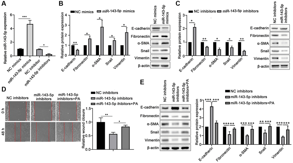 PA enhanced the effect of miR-143-5p in promoting the EMT of ARPE-19 cells. (A) miR-143-5p expression in ARPE-19 cells was determined via quantitative PCR; n = 3 for each group. (B) Protein expression of E-cadherin, Fibronectin, α-SMA, Snail, and Vimentin protein levels in ARPE-19 cells transfected with NC or miR-143-5p mimics (n = 3 for each group). (C) Protein expression of E-cadherin, Fibronectin, α-SMA, Snail, and Vimentin in ARPE-19 cells transfected with NC or miR-143-5p inhibitors (n = 3 for each group). (D) Migration of ARPE-19 cells after the overexpression of miR-143-5p inhibitors or/and PA treatment (n = 3 for each group). (E) Expression of E-cadherin, Fibronectin, α-SMA, Snail, and Vimentin in ARPE-19 cells after the overexpression of miR-143-5p inhibitors or/and PA treatment (n = 3 for each group). *P **P ***P 