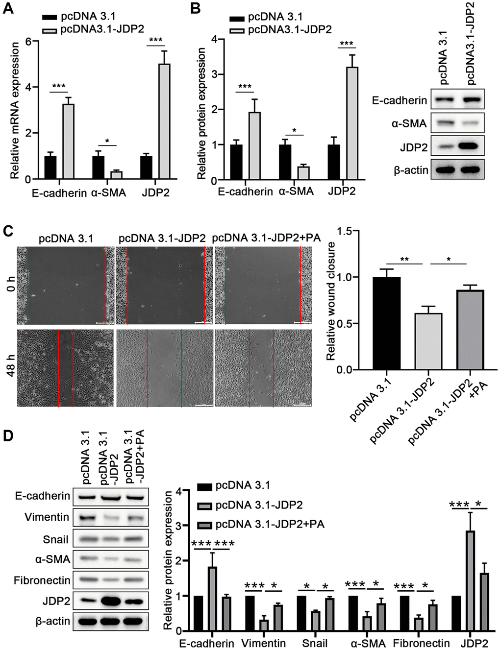 JDP2 inhibited the EMT of ARPE-19 cells. (A) The mRNA levels of E-cadherin and α-SMA in ARPE-19 cells transfected with empty vector or JDP2-expressing plasmid were determined via quantitative PCR. (B) Relative protein expression E-cadherin and α-SMA in ARPE-19 cells transfected with empty vector or JDP2-expressing plasmid (n = 3 for each group). (C) Migration of ARPE-19 cells after the overexpression of JDP2 or/and PA treatment (n = 3 for each group). (D) Expression of E-cadherin, Vimentin, Snail, α-SMA, Fibronectin, and JDP2 in ARPE-19 cells after the overexpression of JDP2 or/and PA treatment (n = 3 for each group). *P **P ***P 