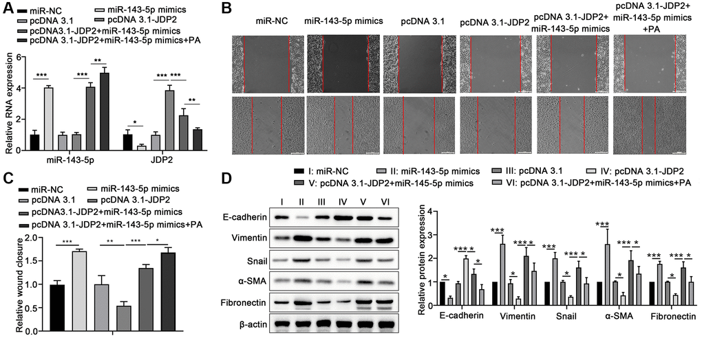 Overexpression of JDP2 inhibited the miR-143-5p–induced EMT in ARPE-19 cells. (A–D) ARPE-19 cells were transfected with miR-NC alone, miR-143-5p mimics alone, pcDNA 3.1 plasmid alone, pcDNA 3.1-JDP2 plasmid alone, pcDNA 3.1-JDP2 plasmid together with miR-143-5p mimics, or pcDNA 3.1-JDP2 plasmid together with miR-143-5p mimics and followed by PA treatment. (A) Relative levels of miR-143-5p and JDP2 mRNA in ARPE-19 cells in different treatment groups were determined via quantitative PCR. (B, C) Migration of ARPE-19 cells in different treatment groups was determined via wound healing assay. (D) Western blot assays determined the protein expression of E-cadherin, Vimentin, Snail, α-SMA, and Fibronectin in ARPE-19 cells in different treatment groups (n = 3 for each group). *P **P ***P 