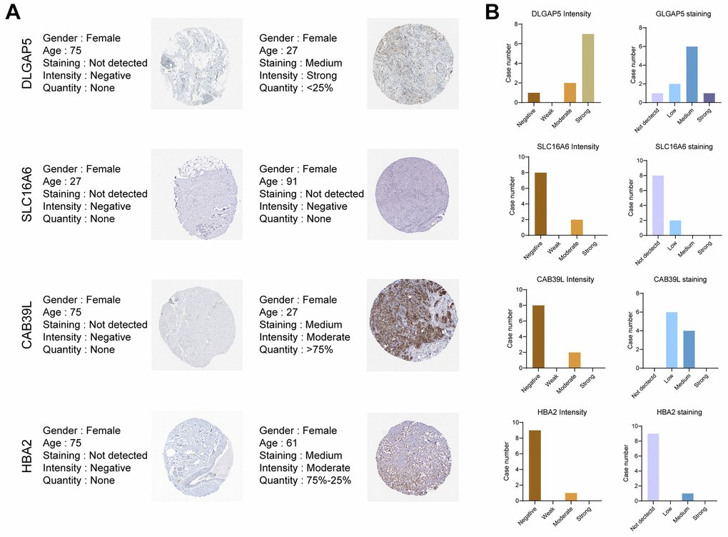 Validation of the 5 BCCGs in normal breast tissue and BC tissue. (A) IHC staining of protein expression for 5 BCCGs. (B) Bar charts represent IHC staining and intensities for five BCCGs.