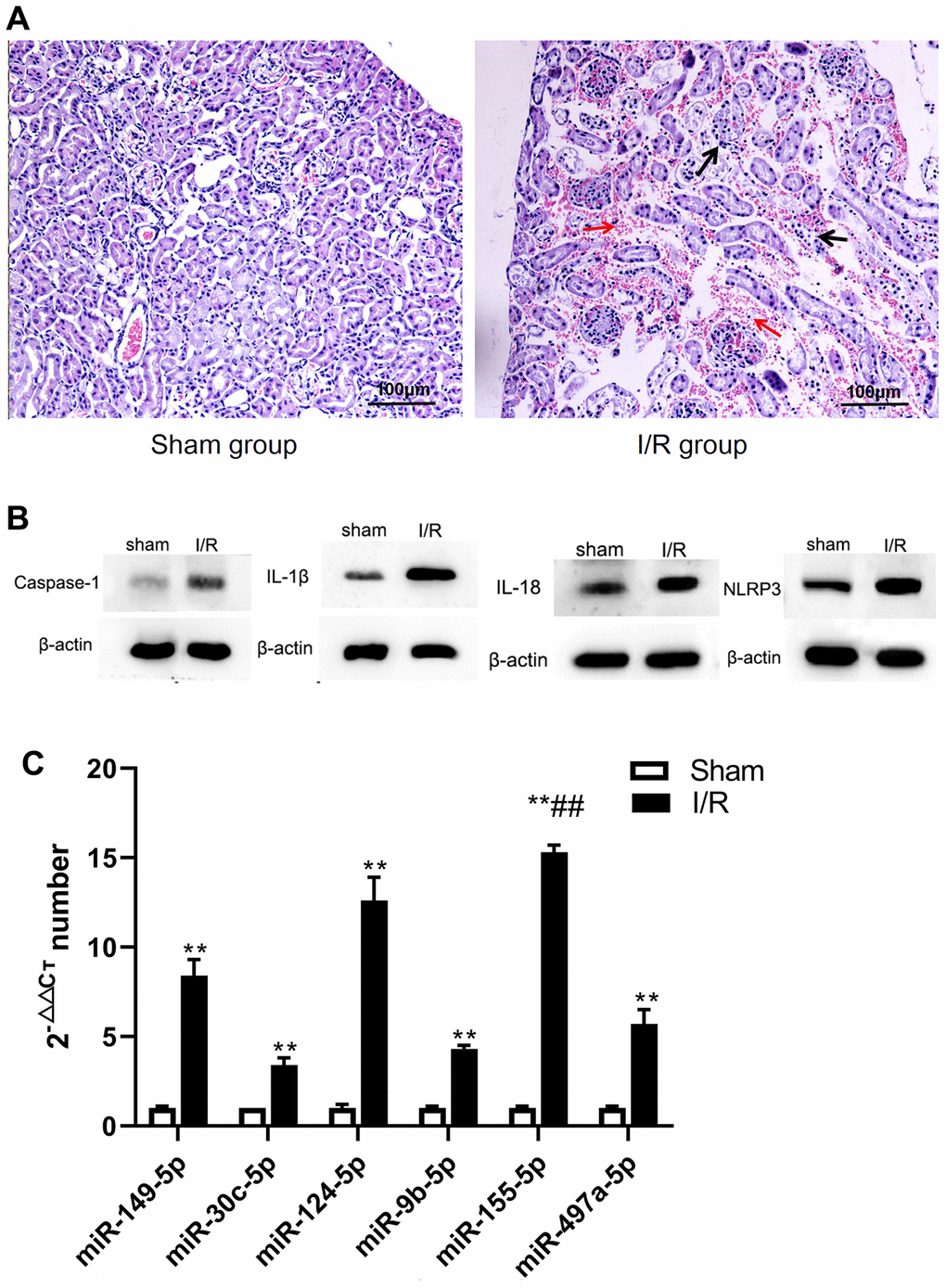 The changes of renal pathological, microRNA and pyroptosis related factors in sham and I/R group. (A) Pathological changes of renal tissue (400 ×). (B) microRNA changes. (C) Expression of caspase-1, IL-1β, IL-18. and NLRP3. (**p