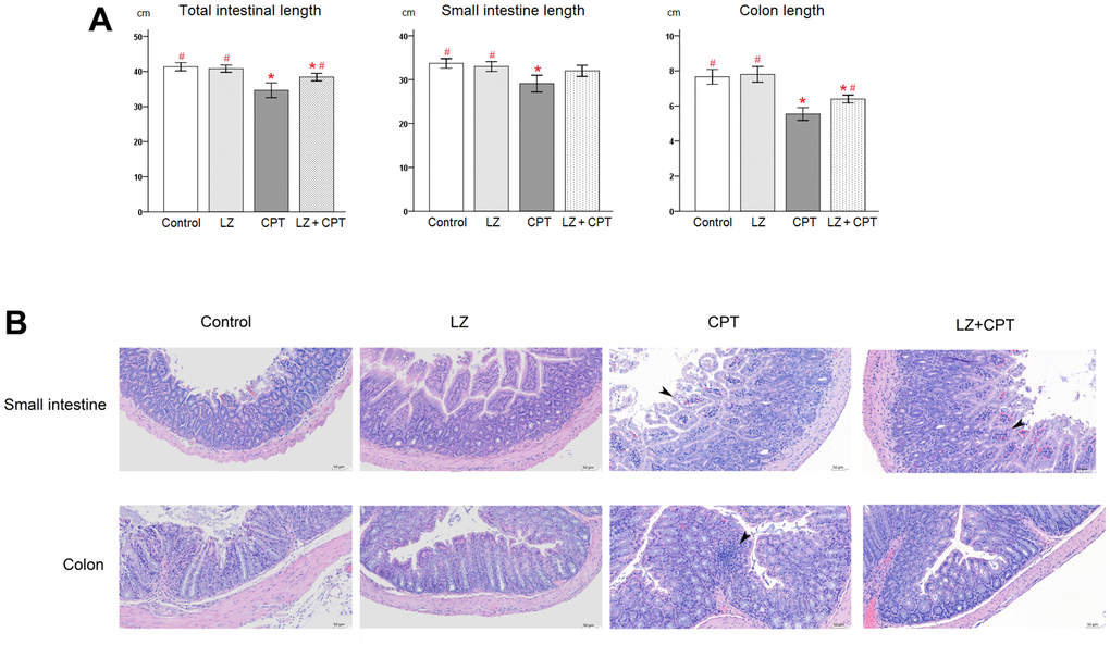 Protective effects of LZ-8 on intestinal damage by CPT-11 in mice. (A) Lengths of the total intestine, small intestine, and colon in mice following different treatments. No obvious changes of the intestinal lengths were observed in mice of the LZ group, but significant shortening of the intestinal lengths was noted in mice of the CPT group. The reduction in intestinal lengths was ameliorated in mice of the LZ+CPT group, compared to the CPT group. Data were presented as mean ± SD, and one-way ANOVA was used for statistical analysis. * indicates P P B) Microscopic histopathology of the small intestine and colon tissue sections from mice with different treatments (H&E staining, 200×). Normal intestinal architecture was noted in the control and LZ groups. The small intestine section of the CPT and LZ+CPT groups showed an edematous change of the intestinal villi with hyperemia (arrowhead) and prominent infiltration of inflammatory cells into the lamina propria. The major abnormal finding in the colon section was the increase of inflammatory cells in the lamina propria (arrowhead). Compared to the CPT group, the histopathologic alterations were attenuate in the LZ+CPT group, with nearly normal architecture of the colon.