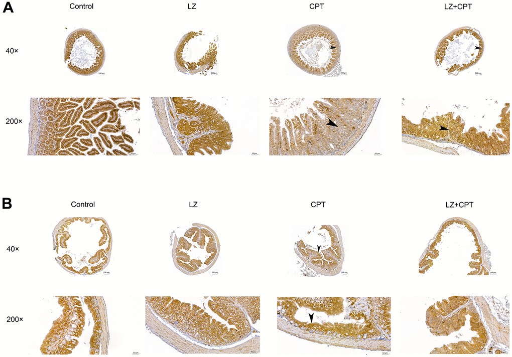 Restoration of claudin-1 expression in the intestinal membranes by LZ-8 treatment in mice with CPT-11-induced intestinal injury, assessed by immunohistochemical staining. (A) The small intestine sections (40× and 200×). (B) The colon sections (40× and 200×). Homogeneous strong membrane staining (3+) was noted in the control and LZ groups. The intensity diminished in the CPT group, only 1+ in the small intestine section (arrowhead) and 2+ in the colon section (arrowhead). Compared to the CPT group, the intensity increased in the LZ+CPT group, showing 2+ in the small intestine section (arrowhead) and 3+ in the colon section (arrowhead).