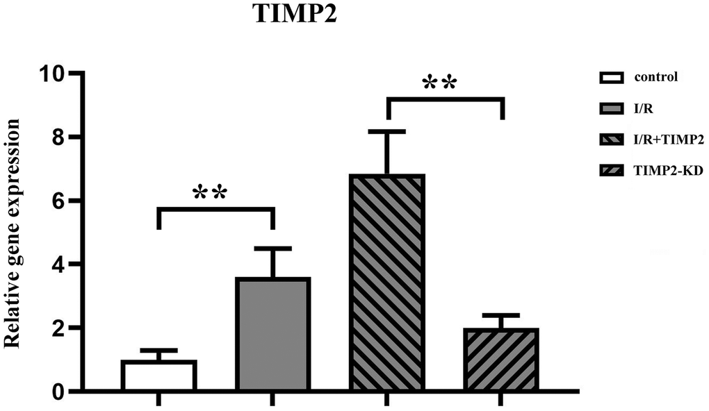 TIMP2 aggravates brain tissue injury in CIRI mice. QPCR is used to measure the expression of TIMP2 in the control, I/R, and I/R+TIMP2 groups. The expression of TIMP2 is significantly higher in the I/R group and the I/R+TIMP2 group than that in the control group. In addition, the expression of TIMP2 is significantly higher in the I/R+TIMP2 group than that in the I/R group. **P *P 