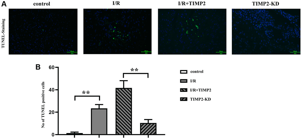 TIMP2 can aggravate neuronal apoptosis in CIRI mice. (A, B) TUNEL staining is performed to observe neuronal apoptosis in the control, I/R, and I/R+TIMP2 groups. In the control group, there is basically no green fluorescence, while the number of TUNEL-positive cells is larger in the I/R and I/R+TIMP2 groups compared with that in the control group. Furthermore, the number of TUNEL-positive cells is significantly larger in the I/R+TIMP2 group than that in the I/R group. In contrast, the number of TUNEL-positive cells is significantly smaller in the TIMP2-KD group than that in the I/R group. These results suggested that TIMP2 may aggravate neuronal apoptosis in mice with CIRI. **P *P 
