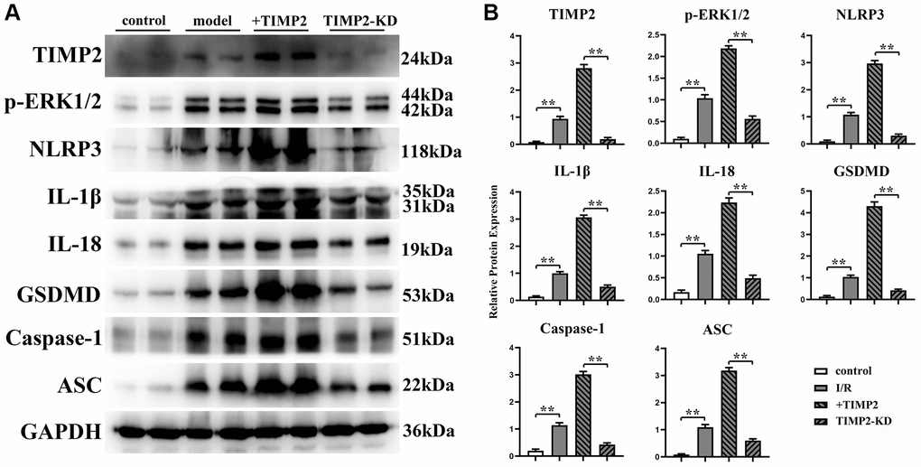 TIMP2 can stimulate NLRP3-mediated cell apoptosis in mice with CIRI. (A) Western blotting is performed to detect the expression levels of TIMP2, p-ERK1/2, NLRP3, and IL-1β in each group. The protein banding diagram of IL-18, GSDMD, Caspase-1, and ASC; (B) The protein expressions of TIMP2, p-ERK1/2, NLRP3, IL-1, IL-18, GSDMD, Caspase-1, and ASC in the control, I/R, I/R+TIMP2, and TIMP2-KD groups. It can be observed that TIMP2 can upregulate the expression of these proteins, indicating that TIMP2 can aggravate cell pyroptosis in mice with CIRI. **P 