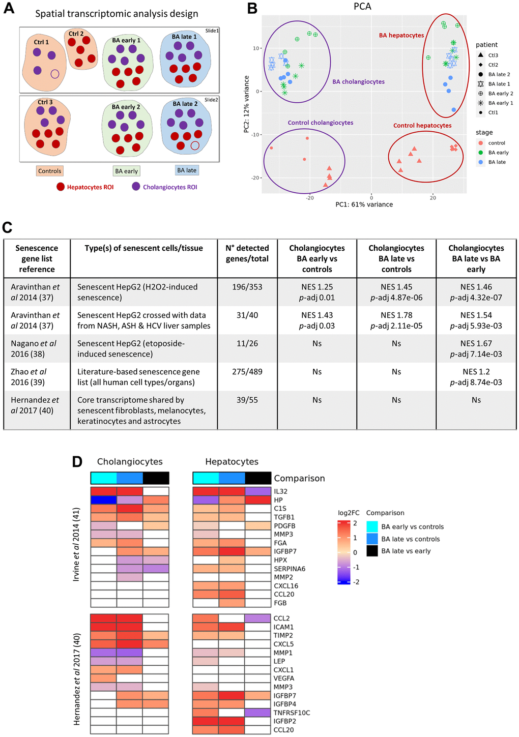 Digital spatial whole transcriptomic analysis in BA livers. (A) Design of the analysis. (B) PCA of the dataset. (C) Enrichment analysis of published senescence gene lists between cholangiocytes subgroups. (D) Heatmaps of SASP genes obtained from two different published datasets in cholangiocytes and hepatocytes subgroups. BA: biliary atresia; Ctrl: control; FC: fold change; NES: normalized enrichment score; p-adj: adjusted p-value; PCA: principal component analysis; ROI: region of interest; SASP: senescence-associated secretory phenotype.