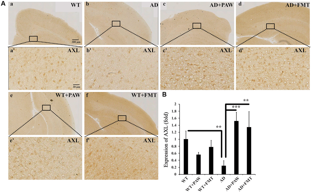 Immunohistochemistry analysis of the protein levels of AXL in the cortex of WT and AD mice. (A) The brains from WT (a, e, f) and AD (b, c, d) mice fed water (a, b), PAW (c, e), and FMT (d, f) were analyzed by immunohistochemistry with anti-AXL. Images (a’–f’) were enlarged from images (a–f). (B) Protein levels of AXL were quantified from (A). All results were analyzed by ANOVA with a post hoc analysis. (*p **p ***p 