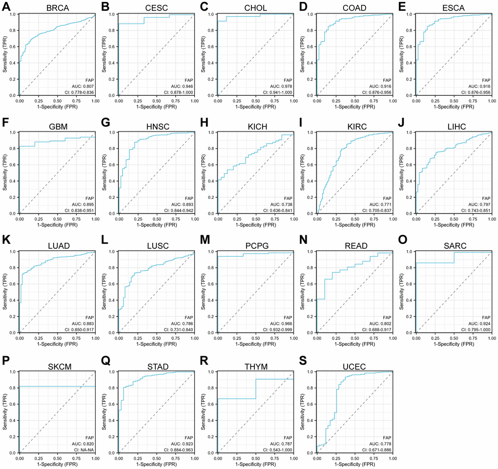 ROC curve analyses for FAP in diverse cancer in TCGA database. (A–S) ROC curve analysis and AUC values for FAP in BRCA, CESC, CHOL, COAD, ESCA, GBM, HNSC, KICH, KIRC, LIHC, LUAD, LUSC, PCPG, READ, SARC, SKCM, STAD, THYM, and UCEC.