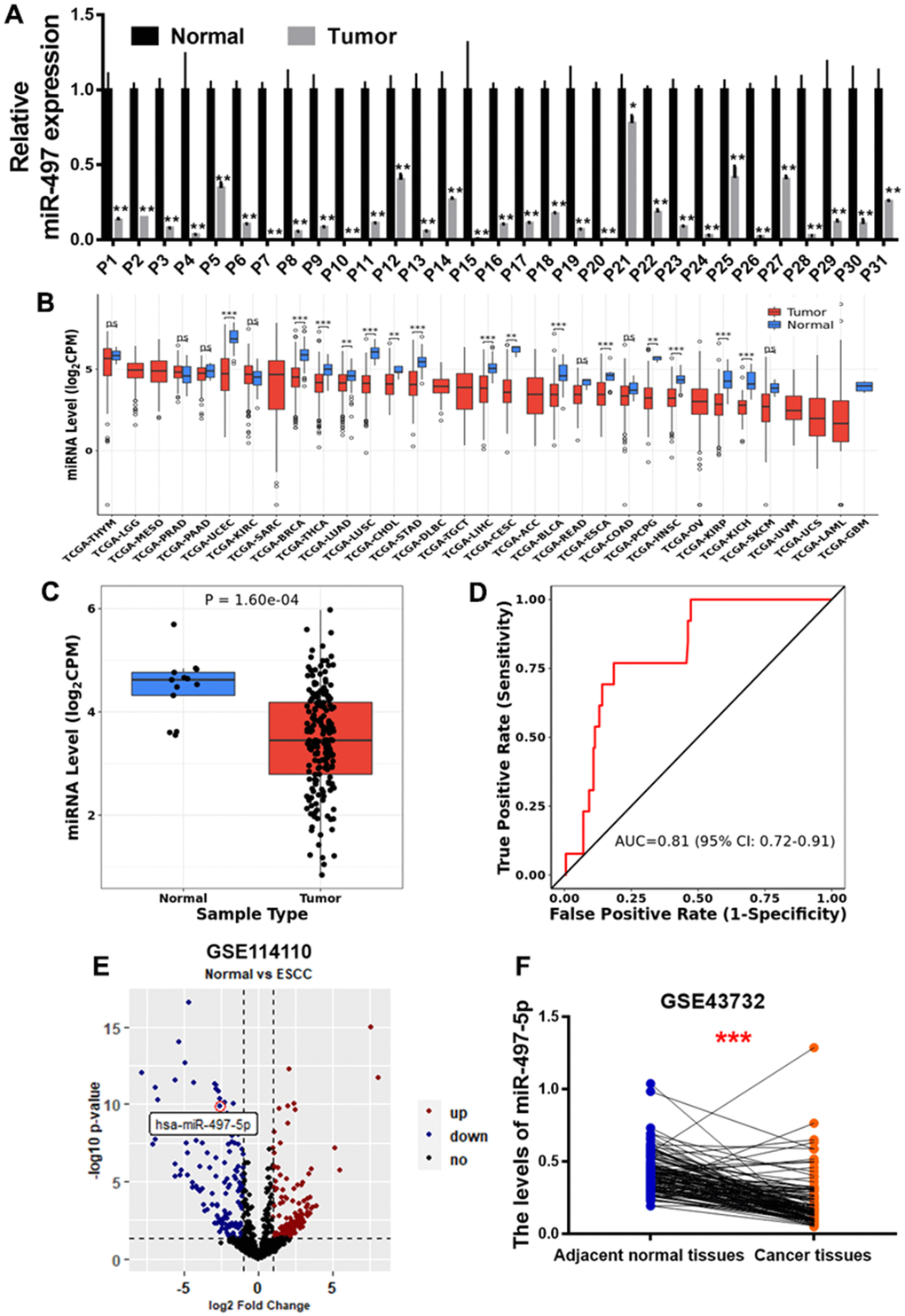 miR-497 expression is down-regulated in the tumor tissues of EC patients. (A) Compared to adjacent normal tissues, the expression levels of miR-497 in EC tissues were significantly lower. (B, C) The result of CancerMIRNome (http://bioinfo.jialab-ucr.org/CancerMIRNome/) database showed that miR-497 levels were much lower in several types of cancer tissues, especially in esophageal cancer. (D) ROC curve showed that miR-497 may be used as a biomarker in EC prognosis. (E) Volcano plot of GSE114110 displayed differentially expressed microRNAs in normal and EC tissues. (F) Analysis of GSE43732 showed that miR-497 expression levels were significantly lower in EC samples. Data were representative of 3 independent experiments. * indicated significant difference at p0.05.