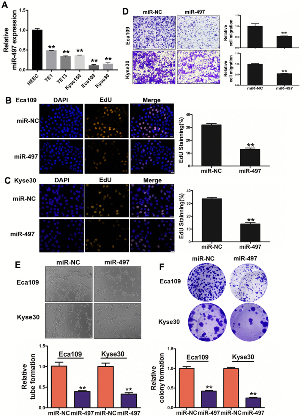 miR-497 overexpression inhibits cell proliferation, migration, tube formation and colony formation. (A) Compared to normal esophageal HEEC cell, the expression levels of miR-497 in EC cell lines were significantly lower. (B, C) Overexpression of miR-497 greatly reduced percentages of EdU staining signals in Eca109 and Kyse30 cells. (D) Overexpression of miR-497 inhibited cell migration activities. (E) The overexpression of miR-497 attenuated tube formation activities. (F) Forced expression of miR-497 attenuated the colony formation activities in cancer cells. All data were representative of 3 independent experiments. ** indicated significant difference at p