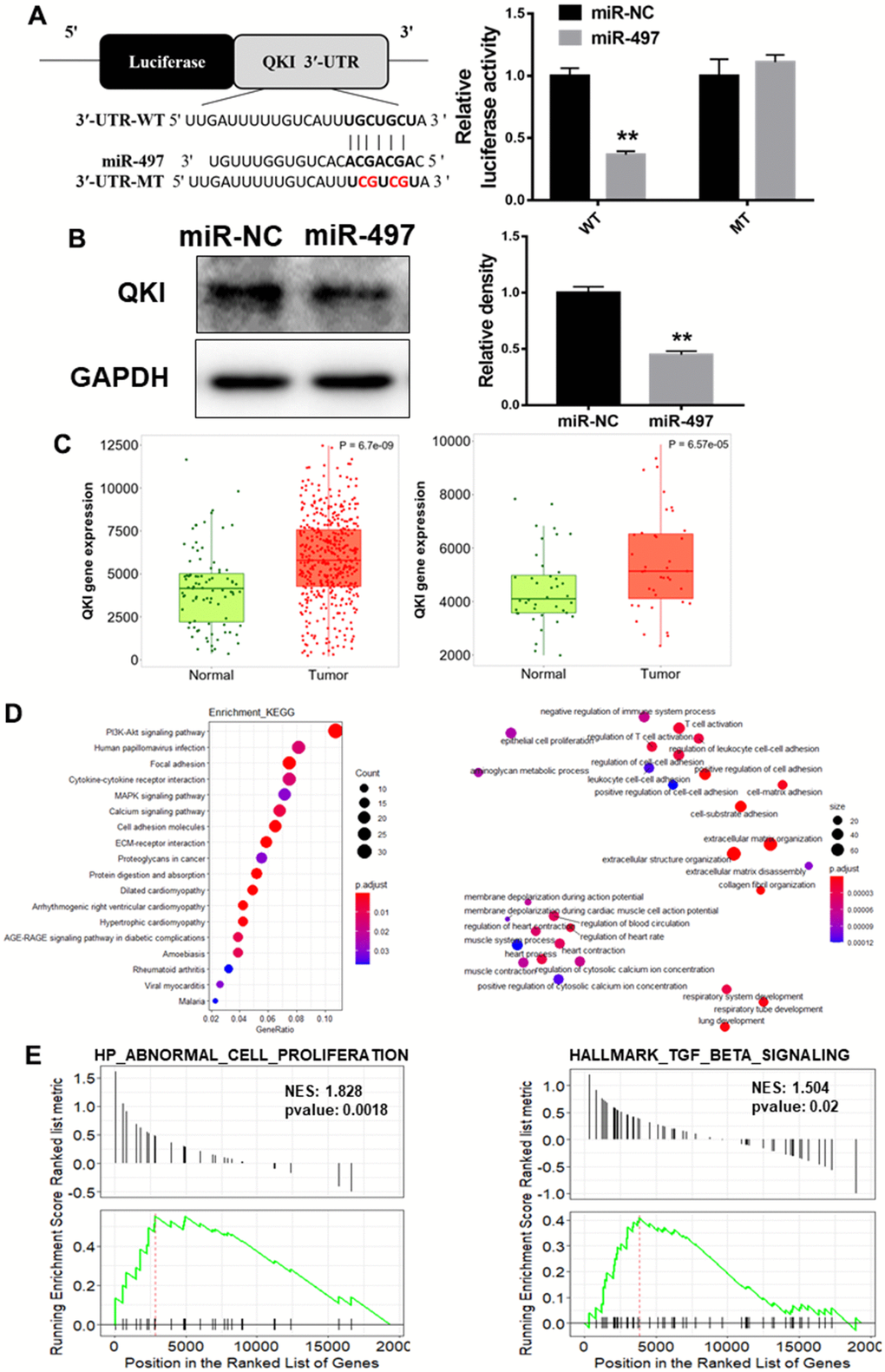 QKI is a direct target of miR-497, and QKI expression levels were correlated with tumor progression in EC samples. (A) Overexpression of miR-497 inhibited the luciferase activity of QKI 3’ UTR reporter. (B) Overexpression of miR-497 greatly inhibited protein expression levels of QKI. (C) The expression levels of QKI were significantly upregulated in non-paired and paired EC tissues compared to the normal ones. (D) KEGG and GO (MF) analysis of esophageal cancer tissues showed that QKI is associated with cell proliferation and cell adhesion signal pathways. (E) GSEA analysis of esophageal cancer tissues conveyed that QKI expression levels were positively correlated with cell proliferation and metastasis in EC tissues. Data were representative of 3 independent experiments. ** indicated significant difference at p