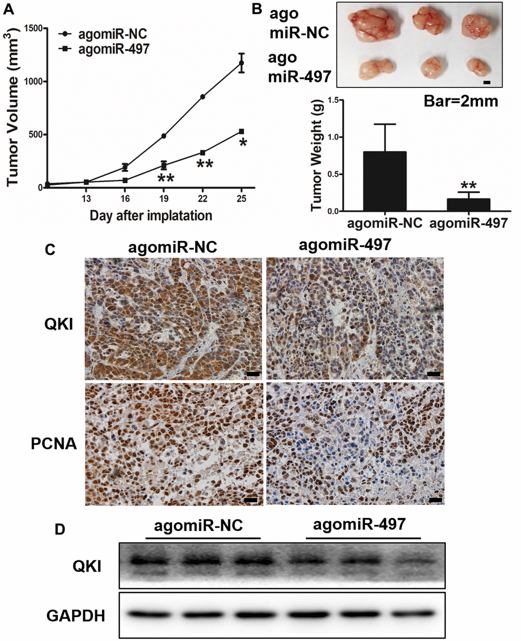 miR-497 overexpression inhibits tumor growth and QKI expression in vivo. (A, B) Overexpression of miR-497 inhibited tumor growth. The photograph showed the representative tumors from each group. Scale bar, 2 mm. Tumor weights from miR-497 overexpression group were significantly decreased compared to control group. Scale bar, 20 μm. (C) Immunohistochemistry (IHC) assay indicated that overexpression of miR-497 inhibited the expression levels of QKI and PCNA. (D) The expression levels of QKI from different tumor tissues as indicated were analyzed by immunoblotting. Data were representative of 3 independent experiments. * indicated significant difference at p