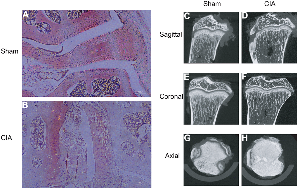 HE staining of mouse joints and micro-CT imaging of mouse joints. (A) HE staining of joints in the Sham group mice. (B) HE staining of joints in the CIA group mice. (C–H) Micro-CT imaging of joints in the Sham and CIA group mice.