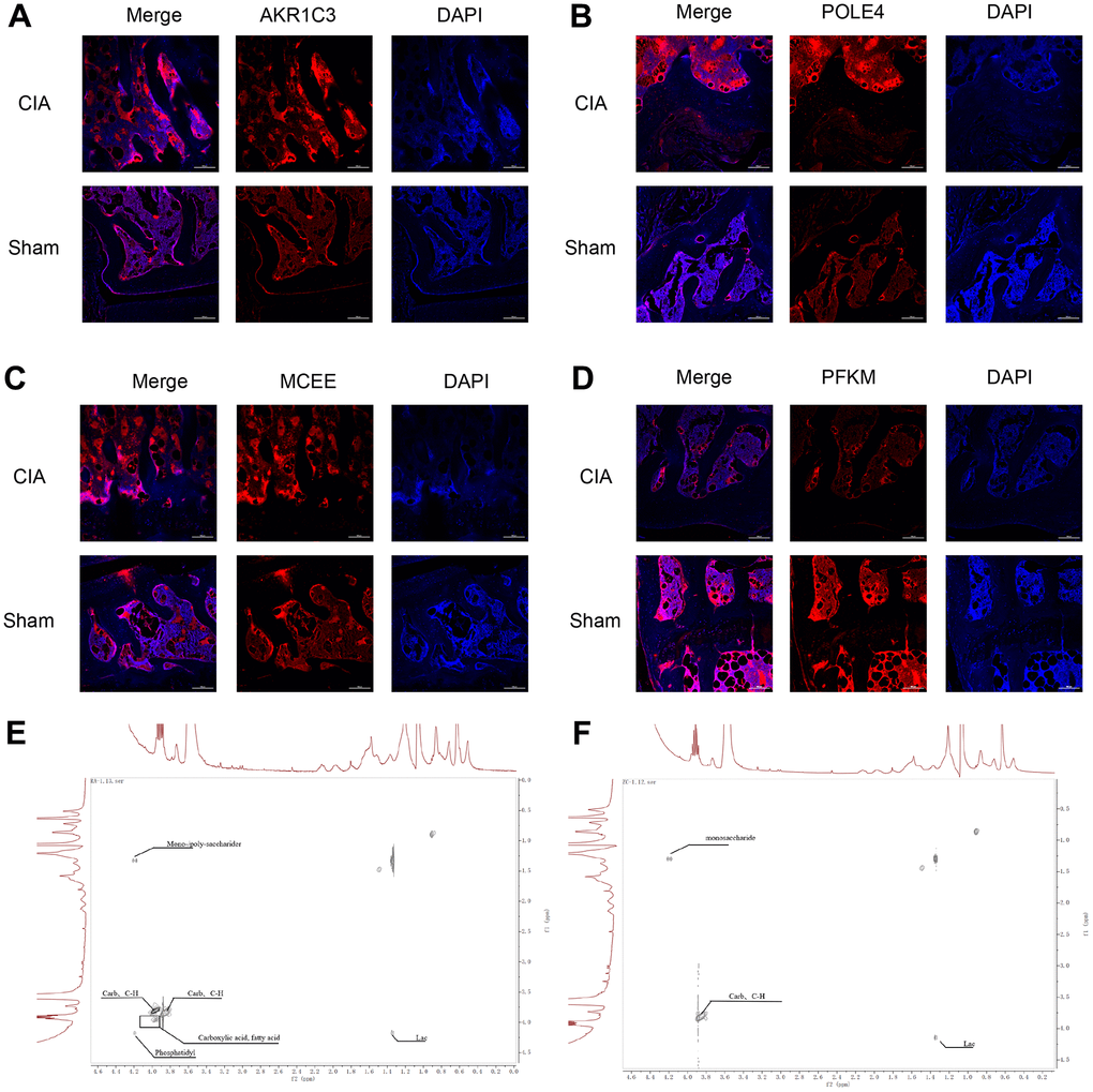 Immunofluorescence staining of AKR1C3, POLE4, MCEE, and PFKM in mouse knee joints and NMR 2D Tocsy spectra of human meniscus tissue. (A) Immunofluorescence staining of AKR1C3 in both groups of mice. (B) Immunofluorescence staining of POLE4 in both groups of mice. (C) Immunofluorescence staining of MCEE in both groups of mice. (D) Immunofluorescence staining of PFKM in both groups of mice. (E) NMR 2D Tocsy spectrum of meniscus tissue from RA patients. (F) NMR 2D Tocsy spectrum of normal meniscus tissue.