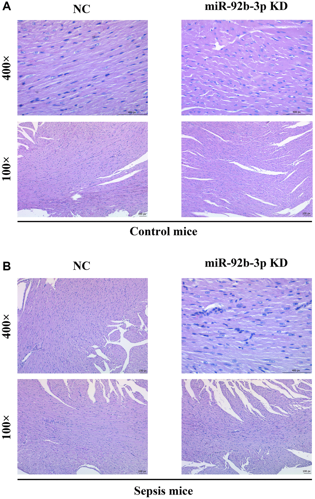 Pathological changes of myocardial tissues in mice. (A) Pathological results of central muscle tissue in mice in the control group; (B) Pathological results of mouse central muscle tissue in the sepsis group.