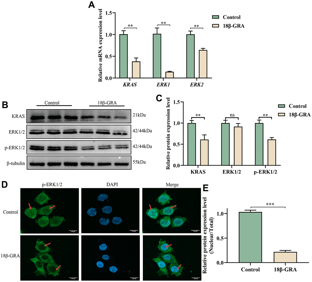 The effect of 18β-GRA on MAPK pathways in AGS cells. (A) qRT-PCR detection of KRAS, ERK1, and ERK2 expression levels. (B) Western blotting analysis revealed the presence of KRAS, ERK1/2, p-ERK1/2 protein expression levels. (C) The results quantify protein levels of KRAS, ERK1/2 and p-ERK1/2 used Image J software. (D, E) The effects of 18β-GRA on nuclear transfer of p-ERK1/2 in AGS cells and statistical chart. All the values are expressed as mean ± SD. Compared with the control group, **p p 