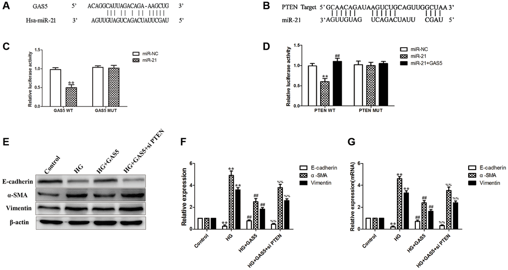 Exosomal lncRNA GAS5 from hUC-MSCs competitively bind to miR-21 to regulate suppression on target PTEN genes to alleviate EMT of HPMCs. (A) Bioinformatics analysis result showed that lncRNA GAS5 had a binding site with miR-21. (B) Bioinformatics analysis result showed that PTEN had a binding site with miR-21. (C) Dual-luciferase reporter gene assay was used to analyze the relationship between lncRNA GAS5 and miR-21. (D) Dual-luciferase reporter gene assay was used to analyze the relationship among PTEN, miR-21, and lncRNA GAS5. (E) Transfection with lncRNA GAS5 significantly alleviated the HG-induced EMT, however, combination with silencing of PTEN reversed the mitigating effect of lncRNA GAS5 on EMT by Western Blot. (F) Statistical results of EMT changes after transfection with lncRNA GAS5 in combination with silencing of PTEN. (G) The expression of EMT markers was detected by real-time PCR in HPMCs. Each value represents the mean ± SEM (n = 3) (C, D) **P ##P E–G) **P ##P %%P 