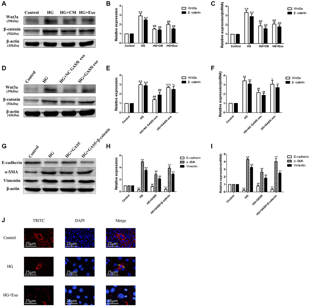 lncRNA GAS5 in exosomes from hUC-MSCs-CM alleviating EMT through Wnt/β-catenin pathway. (A) Exosomes from hUC-MSCs could suppress the Wnt/β-catenin pathway in HG HPMCs by Western Blot. (B) Statistical results of Wnt/β-catenin pathway changes after HG and hUC-MSCs/hUC-MSCs exosomes treatment. (C) The expression of Wnt3a and β-catenin was detected by real-time PCR. (D–F) Exosomes from hUC-MSCs could suppress the Wnt/β-catenin pathway in HG HPMCs by transferring lncRNA GAS5 to HPMCs. (G) After transfection with β-catenin vector, alleviated EMT all reversed in HG+ lncRNA GAS5 group by Western Blot. (H) Statistical results of EMT changes after HG and transfection with lncRNA GAS5 and β-catenin vector. (I) The expression of EMT markers was detected by real-time PCR in HPMCs. (J) Exosomes secreted from hUC-MSCs alleviated the transfer into the nucleus of β-catenin in HG-treated HPMCs. (A–F) **P ##P %%P %P G–I) **P ##P %%P 