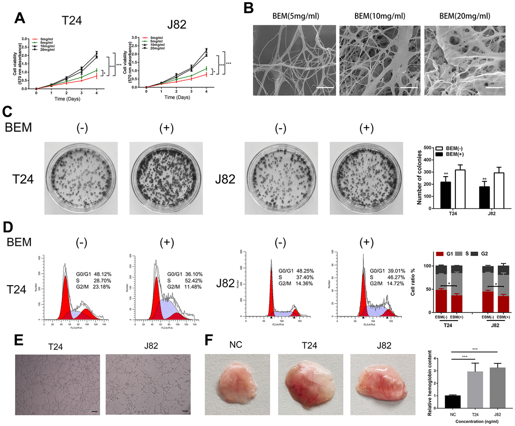 BEM induces cell proliferation and angiogenesis in bladder cancer cells. (A) Cell viability of T24 and J82 cells incubated with BEM hydrogels (0, 5, 10, and 20 mg/mL) for 4 days was evaluated using the MTT assay. (B) SEM images of fibrous collagen structures in BEM hydrogels (5, 10, and 20 mg/mL). Scale bars = 100 nm. (C) Cell cycle distribution of bladder cancer cells treated with BEM hydrogels (0 and 20 mg/mL) for 48 h was evaluated by flow cytometry. The percentage of cells in each phase are shown. (E, F) HUVECs treated with T24 and J82 medium formed capillary-like structures in the, scale bar = 100 μm. *p 