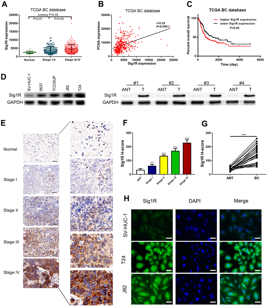 Up-regulation of Sig1R was closely associated with more aggressive clinicopathological features in bladder. (A) One-way ANOVA analysis showed that Sig1R expression levels significantly correlated with the TNM stage in the TCGA BC RNAseq dataset. (B) TCGA BC RNAseq dataset indicated that Sig1R was positively associated with PCNA in bladder cancer tissues. (C) The Kaplan-Meier plot of overall survival in the TCGA cohort is shown according to Sig1R expression. (D) Human bladder epithelial SV-HUC-1 cell, four bladder cancer cell lines and eight paired bladder cancer tissues, and matched adjacent non-tumor tissues (ANT) were collected to evaluate the Sig1R protein expression by immunoblot. GAPDH was used as a loading control. (E, F) Examination of Sig1R expression in bladder cancer and normal tissues by IHC using the H-score approach, scale bar = 100 μm. (G) Examination of Sig1R expression in 40 paired bladder cancer tissues and ANT by IHC using the H-score approach. (H) Sig1R expression and localization in SV-HUC-1 and bladder cancer cell line (T24 and J82) were detected by immunofluorescence, scale bar = 20 μm. **p 