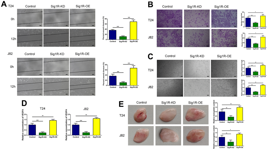 Sig1R enhanced the crosstalk between bladder cells and HUVECs and promoted migration and tube formation in HUVECs. (A, B) Sig1R promoted tumor-induced HUVEC migration according to wound healing and transwell migration assays, scale bar = 100 μm. (C) Sig1R promoted tumor-induced HUVEC angiogenesis according to tube formation assays in BEM in vitro, scale bar = 100 μm. (D) Quantification of VEGFA concentration in CM are shown. (E) Sig1R promoted tumor-induced HUVEC angiogenesis according to tube formation assays in BEM in vivo. *p 